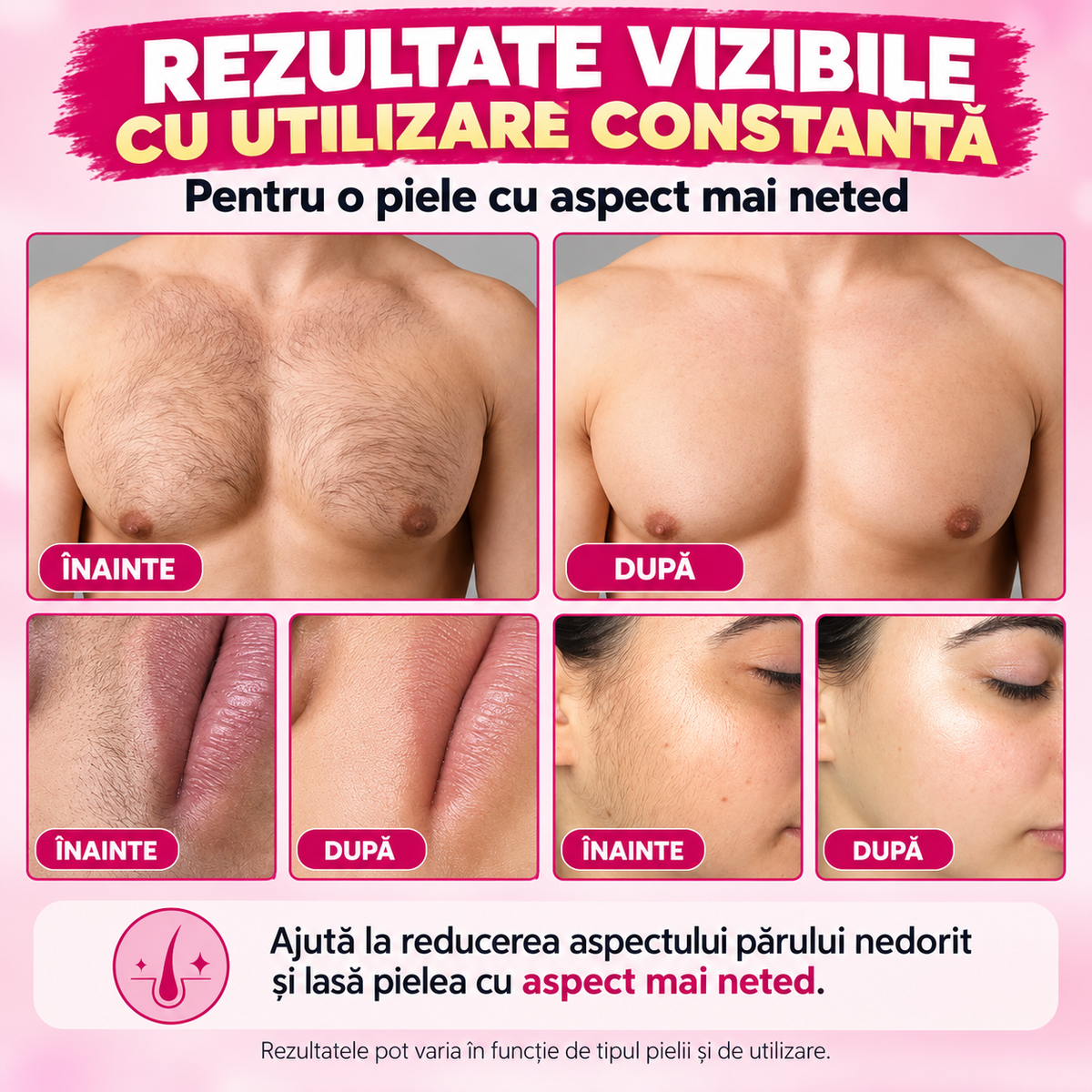 Ulei de Cyperus Rotundus pentru Îngrijirea dupa epilare